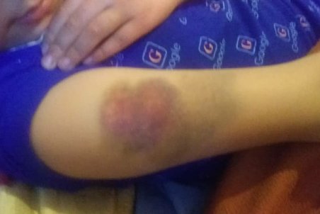 واکنش آموزش و پرورش قزوین به ماجرای تنبیه بدنی دانش‌آموز روستایی