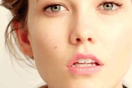 موثر ترین روش های از بین بردن خال کدامند؟