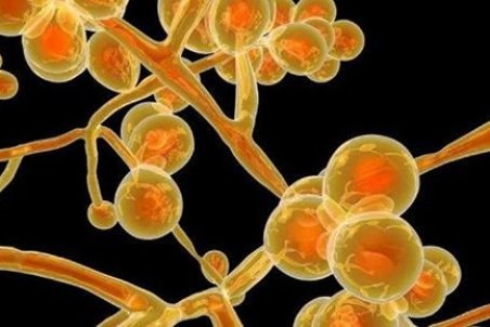 اطلاعاتی برای آشنایی با عفونت قارچی کاندیدا اریس