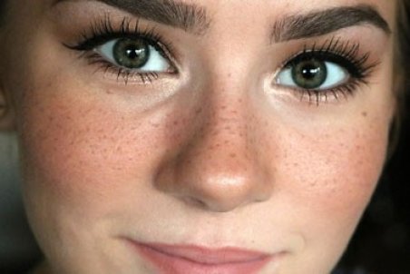 کک و مک چیست و چطور باید با کک و مک کنار آمد؟