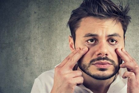 راهکارهای خانگی درمان افتادگی پلک