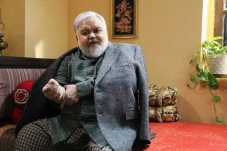 آخرین خبر درباره وضعیت جسمانی اکبر عبدی