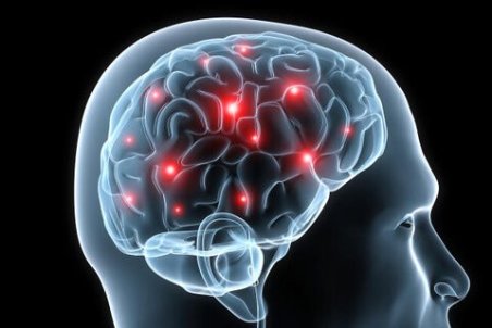 نوروتراپی چیست و چه کاربردهایی دارد؟