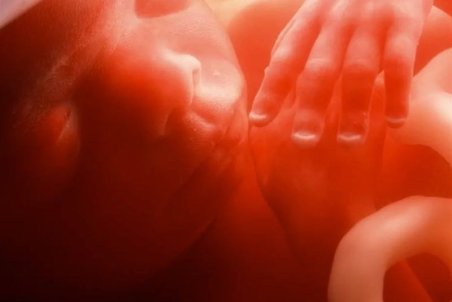 دیه "جنین سقط شده صاحب روح" ۴۸۰ میلیون تومان! + جزئیات