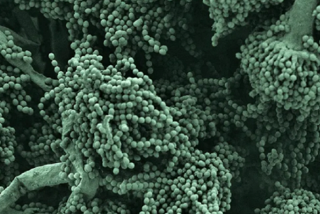 حقایق باورنکردنی درمورد عفونت‌های قارچی