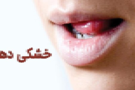 رفع خشکی دهان در ماه رمضان