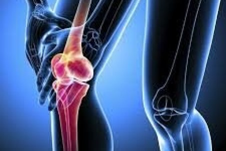 عواملی که باعث کاهش تراکم استخوان می‌شود