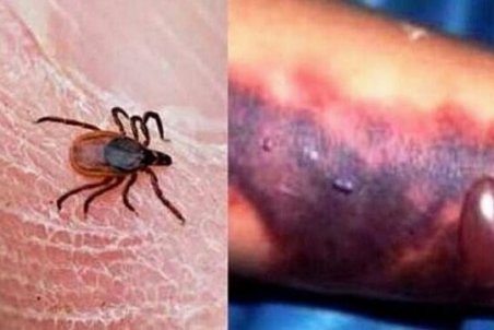 تب کریمه کنگو؛ بی‌خطر در دام، کُشنده برای انسان