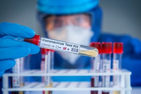 خرید و فروش میلیونی جواب تست کرونا!