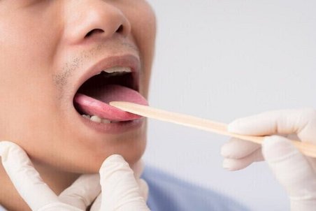 دو علامت در دهان که نشان از سطح بالای قند خون دارد