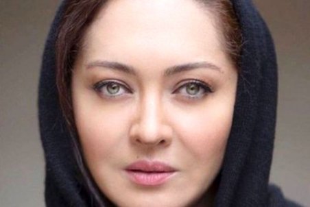 حادثه برای نیکی کریمی در خوزستان / جزییات صدمات جسمی