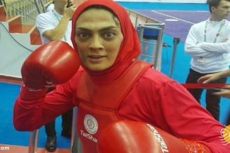 آخرین وضعیت شهربانو منصوریان بعد از عمل جراحی