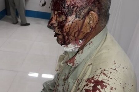 ضاربان محیط بان قمیشلو شناسایی شدند /نیازمند حمایت دستگاه قضایی هستیم