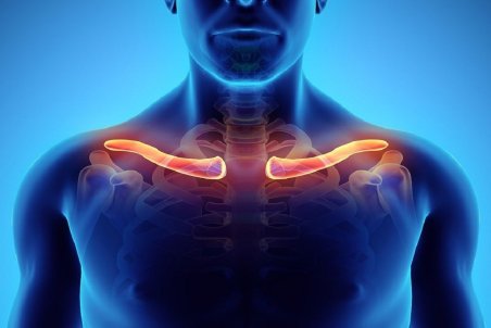 شکستگی ترقوه را چگونه درمان کنیم؟