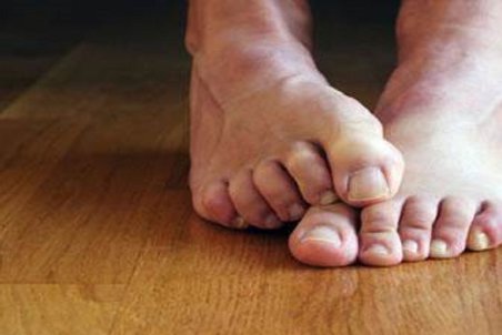 ساده‌ترین راهکار‌ها برای خلاصی از تعریق پا