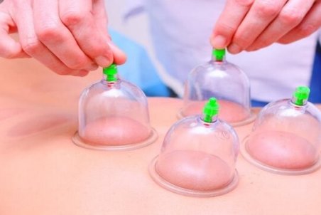 همه افراد می‌توانند "حجامت" کنند؟