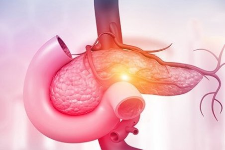 نشانه های سرطان پانکراس