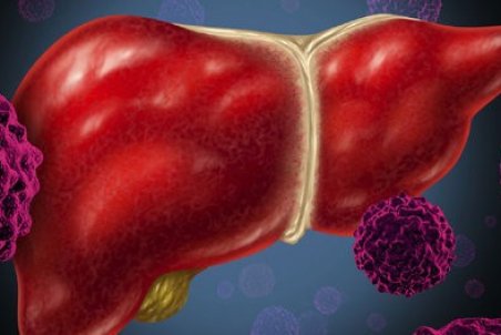 پاسخ به پرسش‌های رایج درباره بیماری هپاتیت E