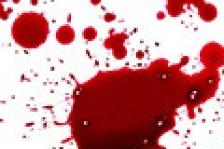 درگیری خونین ۲ پزشک متخصص در نیشابور