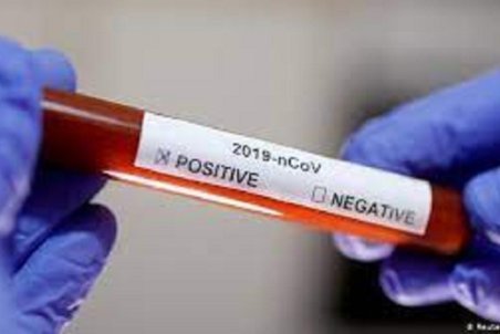شناسایی ۳۵ مورد جدید مبتلا به کرونا ویروس در ایلام