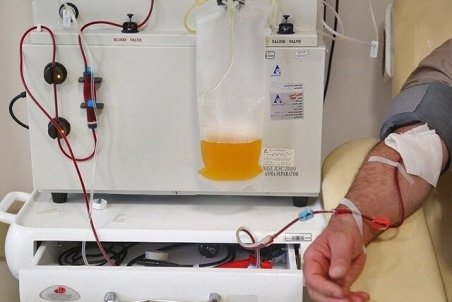 چرا پلاسما درمانی از پروتکل‌های درمان کرونا خارج شد؟