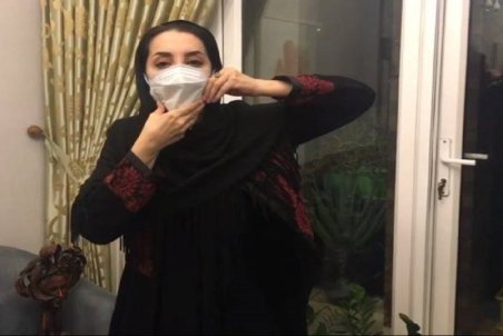 ماجرای عجیب معلولیت فَک سحر جعفری جوزانی!