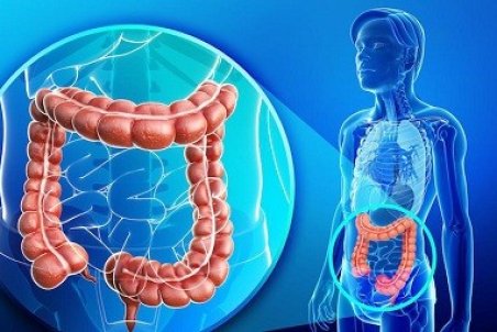 نشانه های افتادگی روده چیست؟ شباهت هموروئید وافتادگی روده