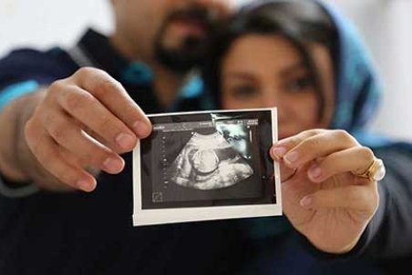حذف اجبار مادران به غربالگری جنین تصویب شد