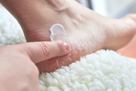 ۶ دلیلی که ترک پاشنه پا را توجیه می‌کند!