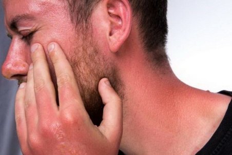 کار‌هایی که پس از ابتلا به آفتاب سوختگی نباید انجام داد