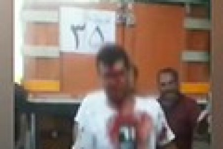 کتک‌زدن جوان مراغه‌ای توسط ماموران شهرداری