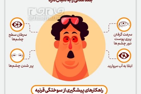 آفتاب سوختگی عمیق چشم چه علائمی دارد؟