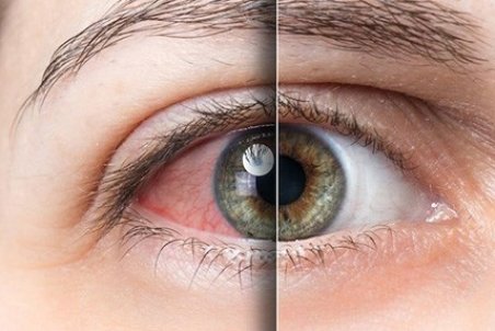 ۱۰ نکته تخصصی برای رفع خستگی چشم