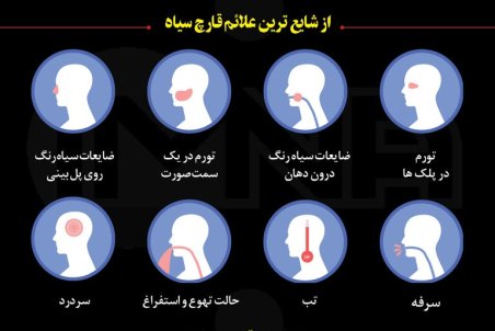 قارچ سیاه در کمین مبتلایان به کرونا+علائم و عوارض موکورمایکوزیس