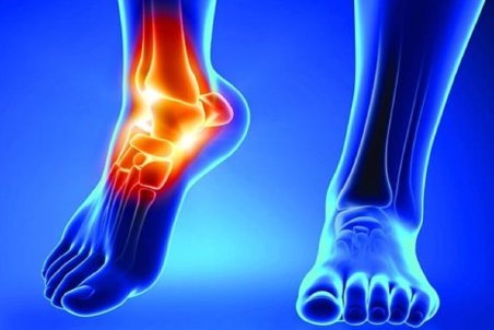 درمان بیماری آرتروز با رژیم غذایی