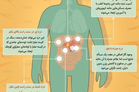اینفوگرافیک / انواع مختلف درد شکم نشانه چیست؟