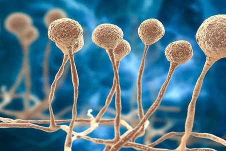 علت کمبود داروی قارچ سیاه چیست؟