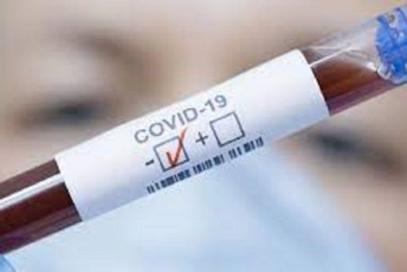 شناسایی ۱۹۰ مورد جدید مبتلا به کرونا ویروس در ایلام /ثبت ۶ مورد فوتی