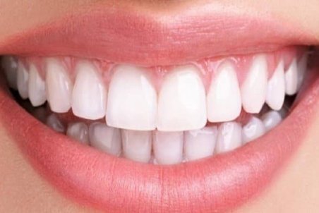 درباره ناهنجارهای دندانی چه می دانید؟