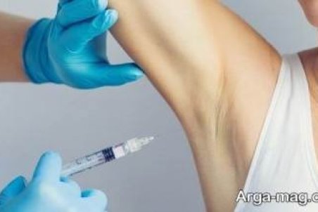 بوتاکس زیر بغل و مراحل تزریق آن