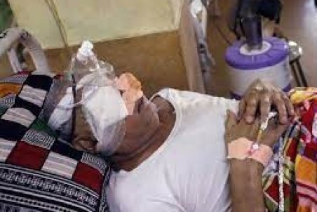 ۲۰ بیمار مبتلا به قارچ سیاه در گلستان بستری هستند