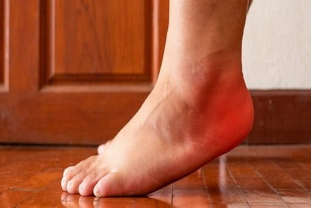 دلایل بروز درد در پاشنه پس از ورزش چیست؟