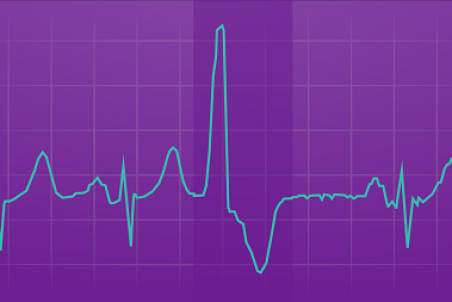 بیماری پی وی سی قلب چیست؟ راههای تشخیص و درمان PVC