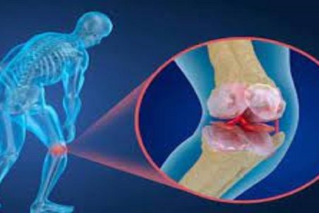 پوکی استخوان چه زمان در زنان شروع می‌شود؟