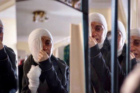 ماجرای اسید پاشی به صورت ترلان پروانه چیست؟