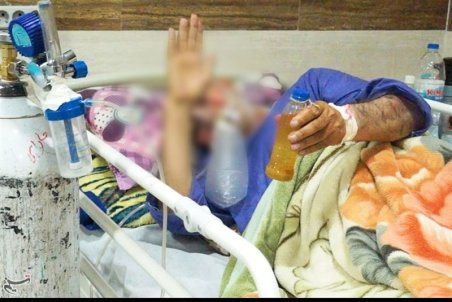 تداوم زنجیره کرونا در گیلان؛ ۱۰۸ بیمار جدید بستری شدند‌