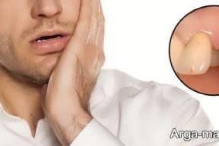 نحوه درمان عفونت دندان کشیده شده