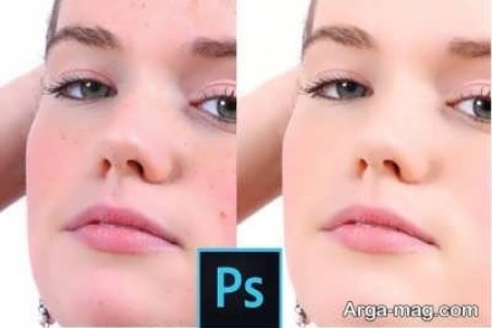 طریقه پاک کردن جوش و لک در نرم افزار فتوشاپ