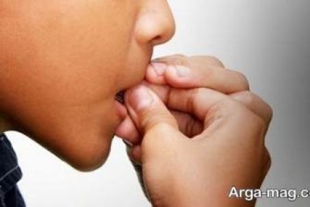 دلیل تیک عصبی صورت چیست؟