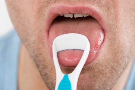 علت طعم فلز در دهان چیست؟